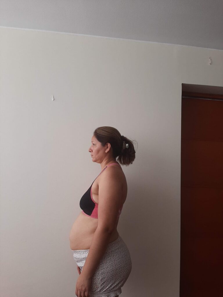 LIZ LLAMOJA 38 AÑOS Before